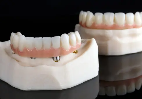 Dentatech - Prótese Dentária no Fluxo Digital em Belo Horizonte